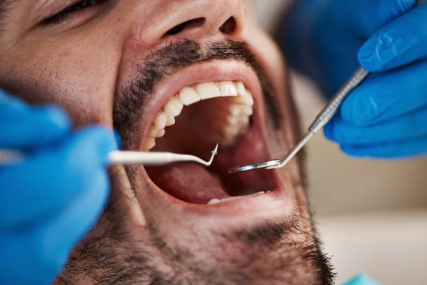 Best Emergency Dentist for Knocked-Out Tooth in Sophia, WV