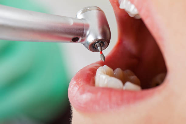 Best Broken or Cracked Tooth Emergency Dentist in Sophia, WV